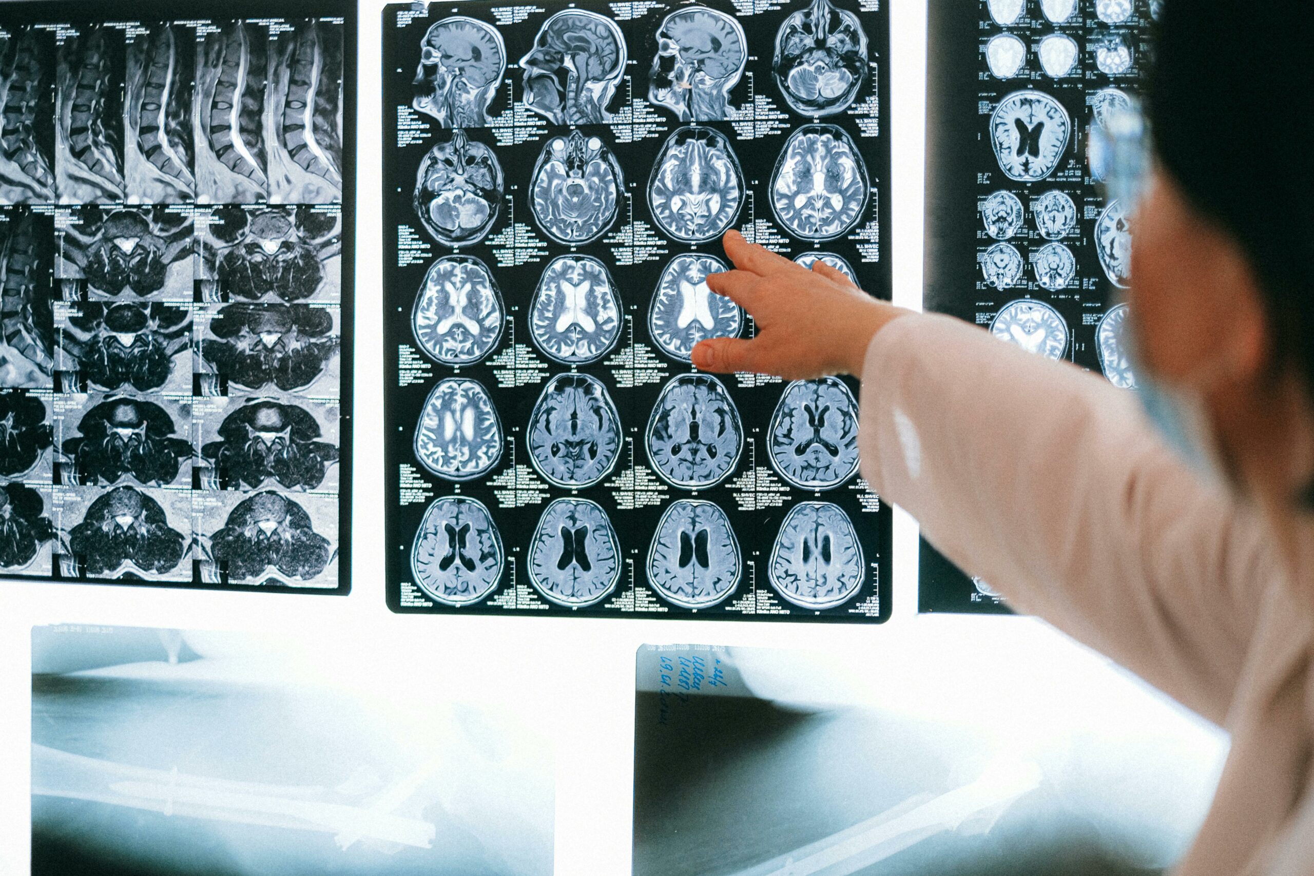 Vârsta biologică a creierului, un indicator esențial pentru speranța de viață, potrivit unui nou studiu Stanford