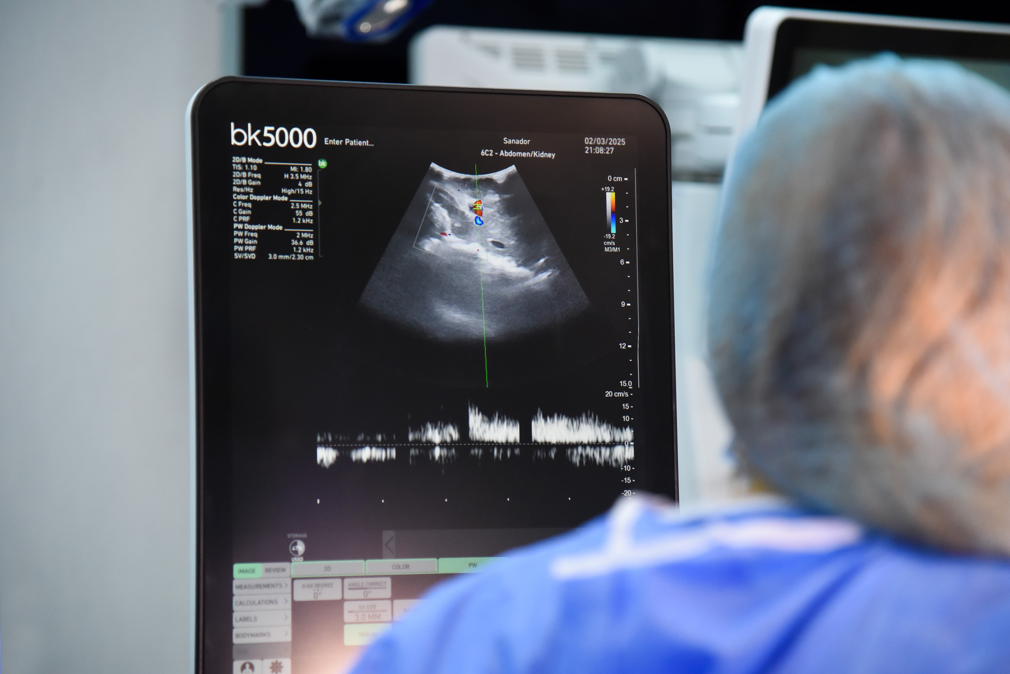 84 de donatori și aproape 300 de transplanturi în România