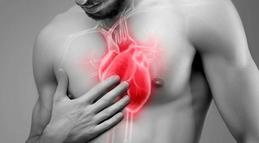 Legătura periculoasă dintre poluare și infarct, confirmată de cercetători