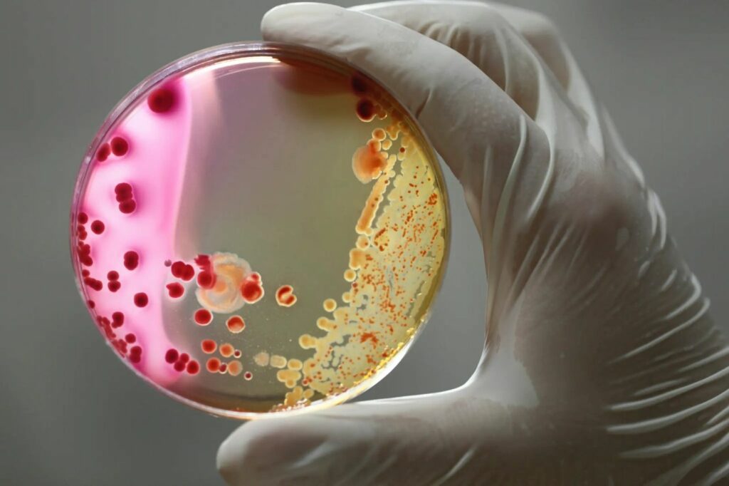 Cum poate o infecție bacteriană să schimbe creierul unui copil