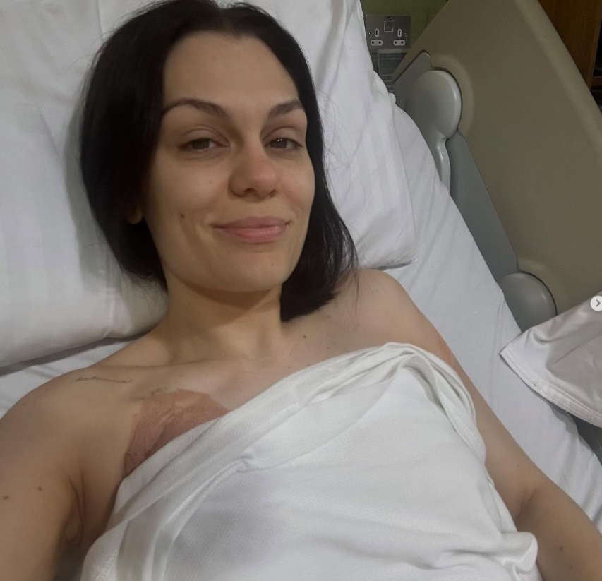 Cântăreața britanică Jessie J a fost operată de cancer la sân