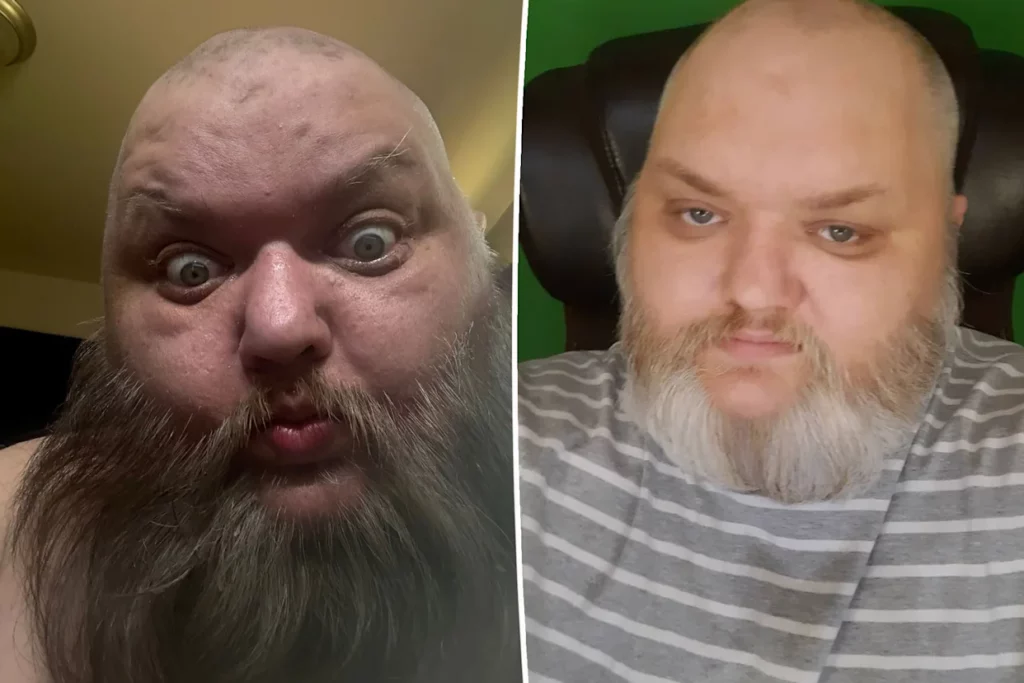 Creatorul de conținut TikTok „KingBeardX” a murit la 47 de ani