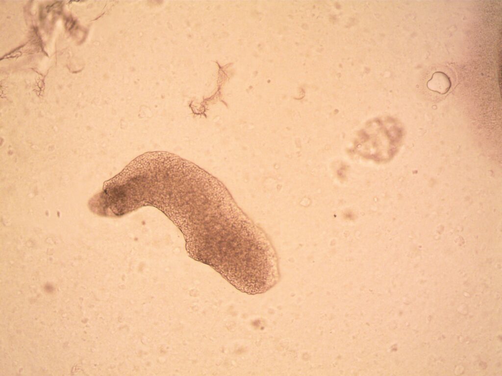 Alerta sanitară în India după creşterea numărului de cazuri de amoebă „mâncătoare de creier”