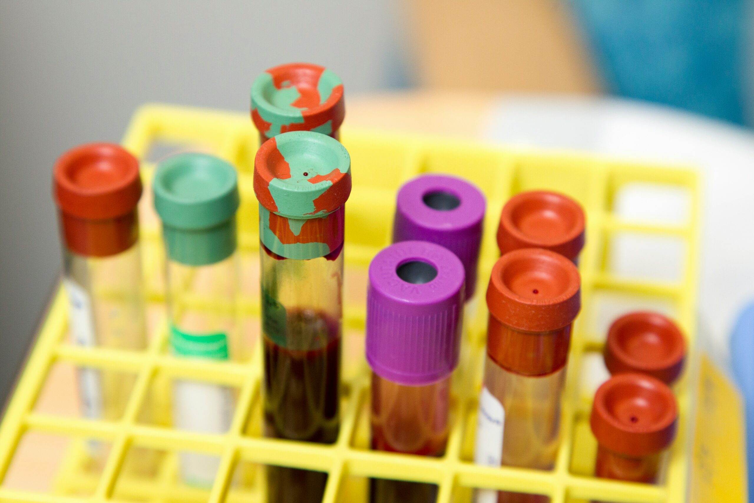 Riscuri de cancer pentru angajații din sănătate în UE