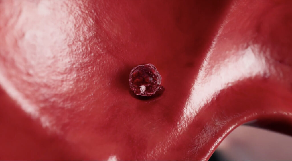 Studiu: Munca de noapte crește riscul de cancer