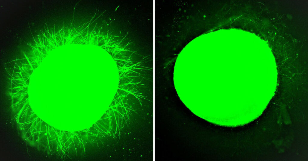 Un pas uriaș spre tratarea paraliziei: țesutul nervos uman s-a regenerat în laborator