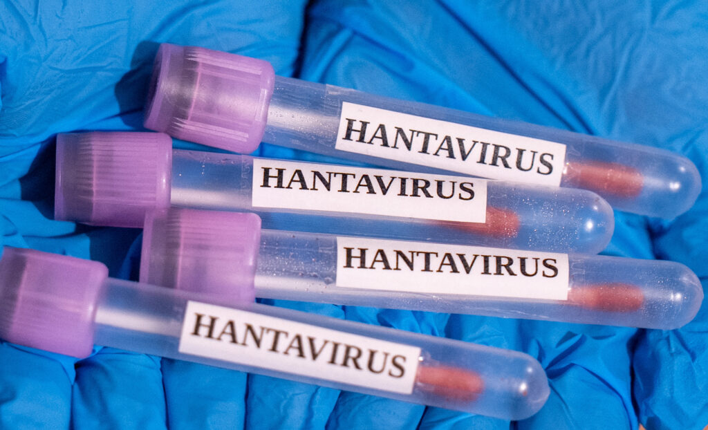 Femeia franceză infectată cu hantavirus rămâne în stare gravă la terapie intensivă