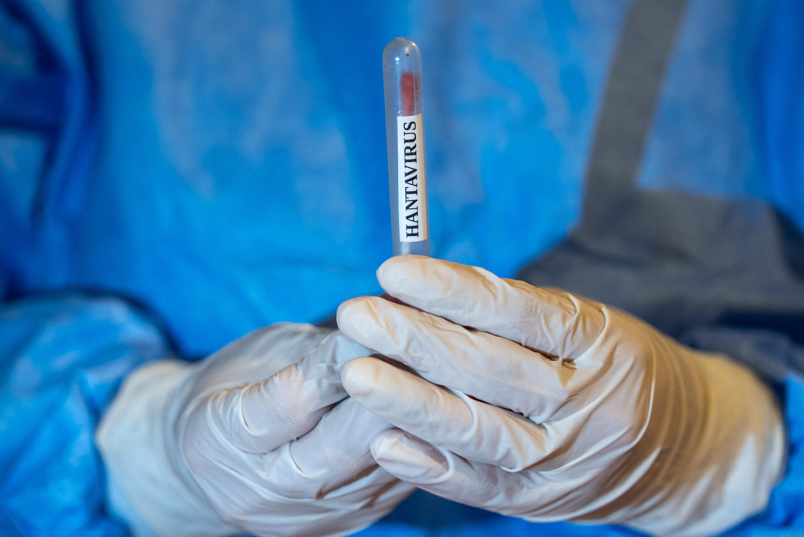 Poza pentru articolul Femeia internată într-un spital din Alicante din cauza suspiciunii de hantavirus a ieșit negativă la testul PCR. Ce urmează