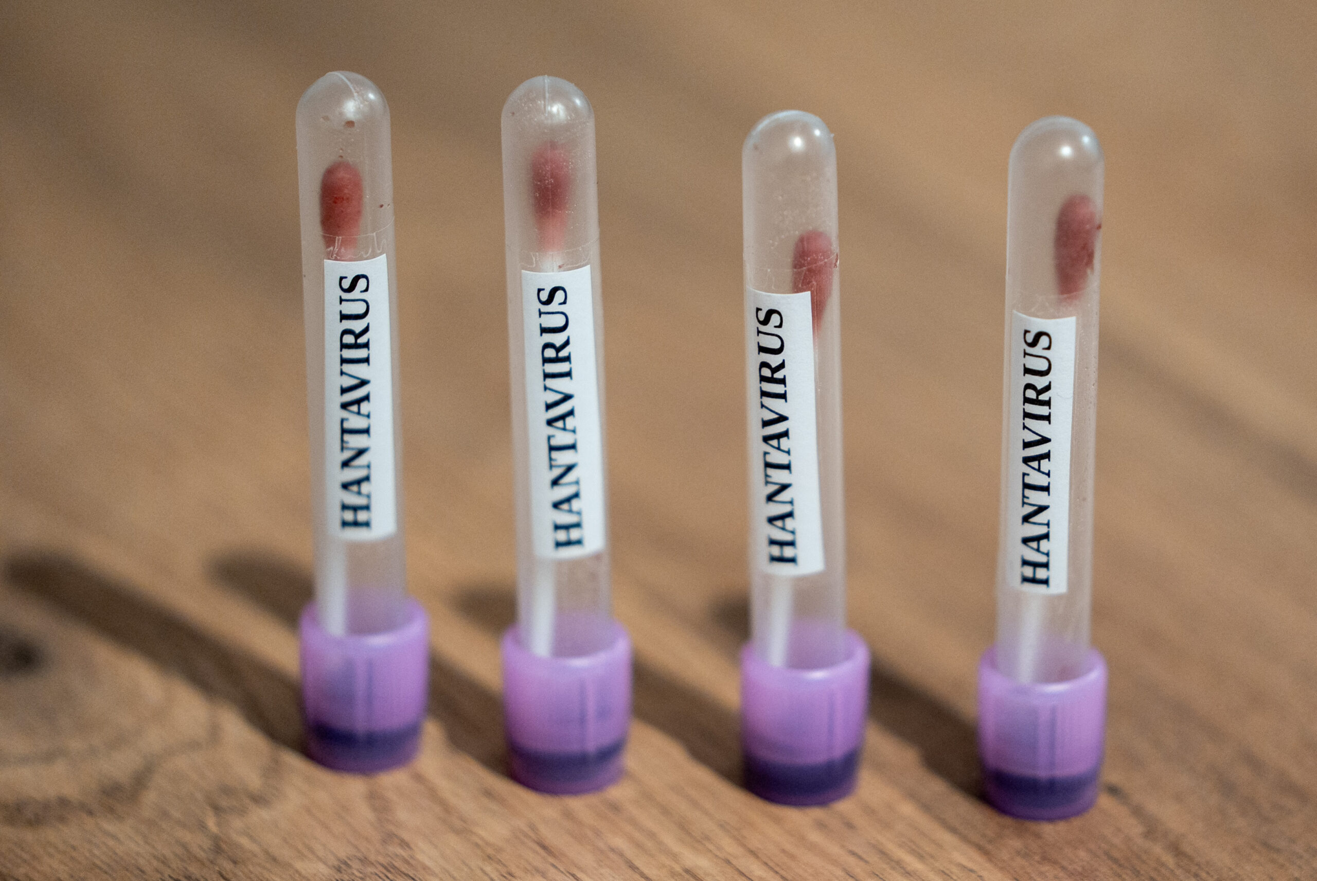 Hantavirus: Rozătoare capturate în Ushuaia