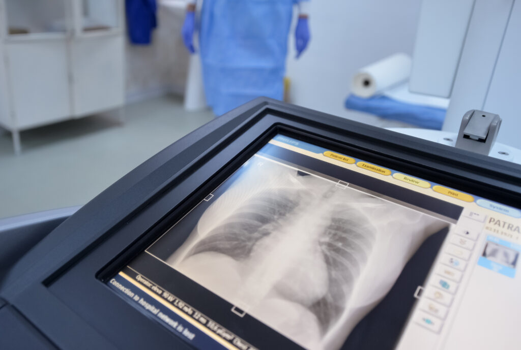 Nu este inima și nici creierul. Organul care ar putea influența longevitatea