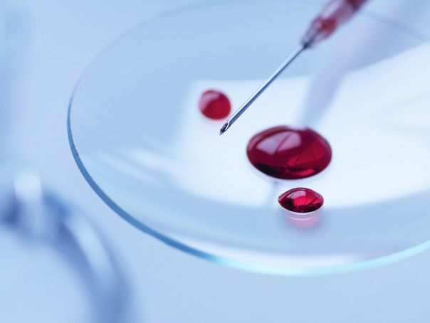 Statele Unite aprobă un nou tratament promițător de prevenire a HIV