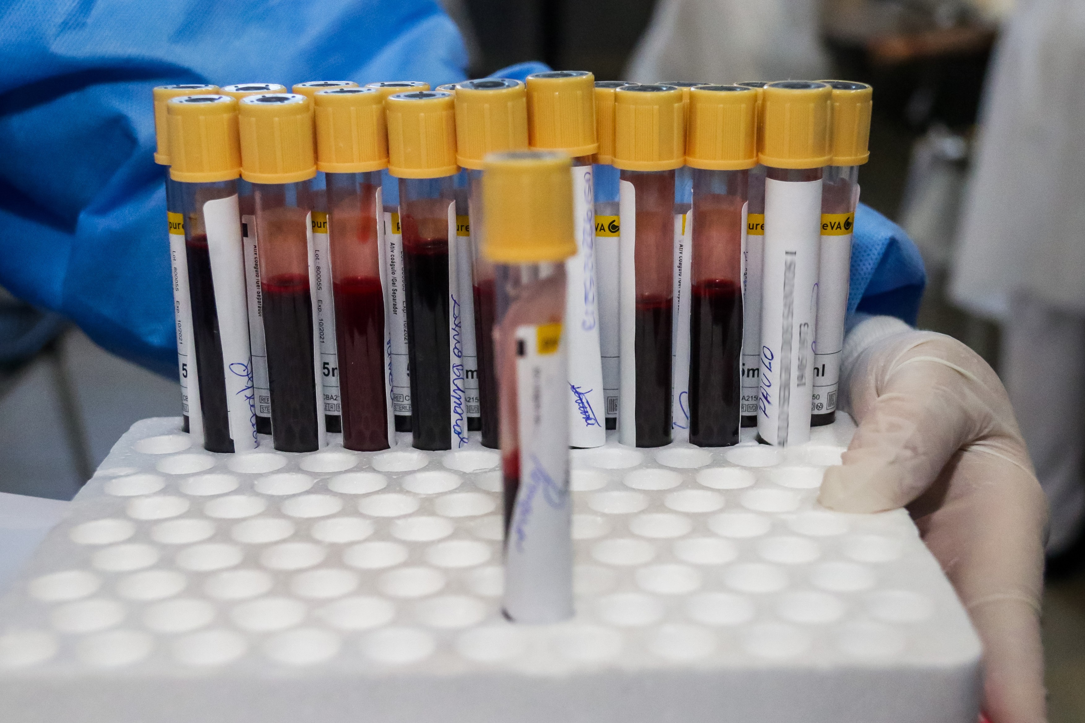 Un test de sânge pentru mai mult de 50 de tipuri de cancer ar putea contribui la accelerarea diagnosticării – studiu