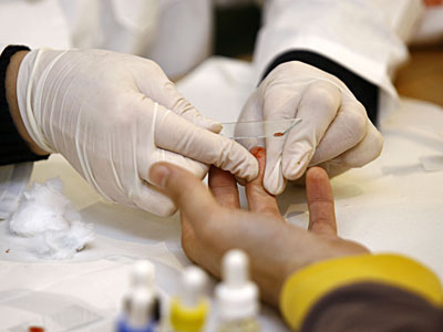 Primul „test de sânge precis” pentru detectarea sindromului de oboseală cronică