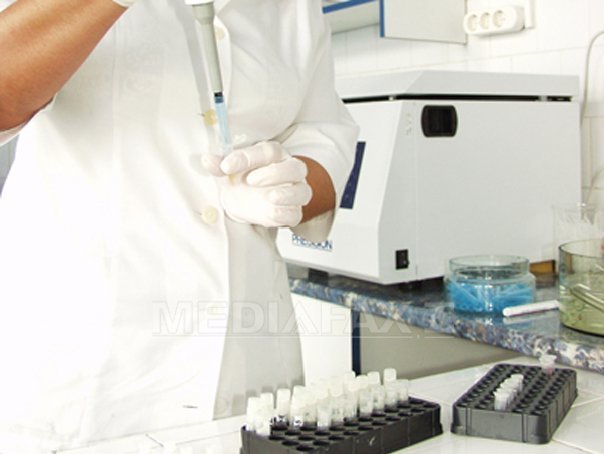 Un test de sânge ar putea revoluţiona diagnosticul Alzheimer. La fel de precis, dar de zece ori mai ieftin și mai rapid