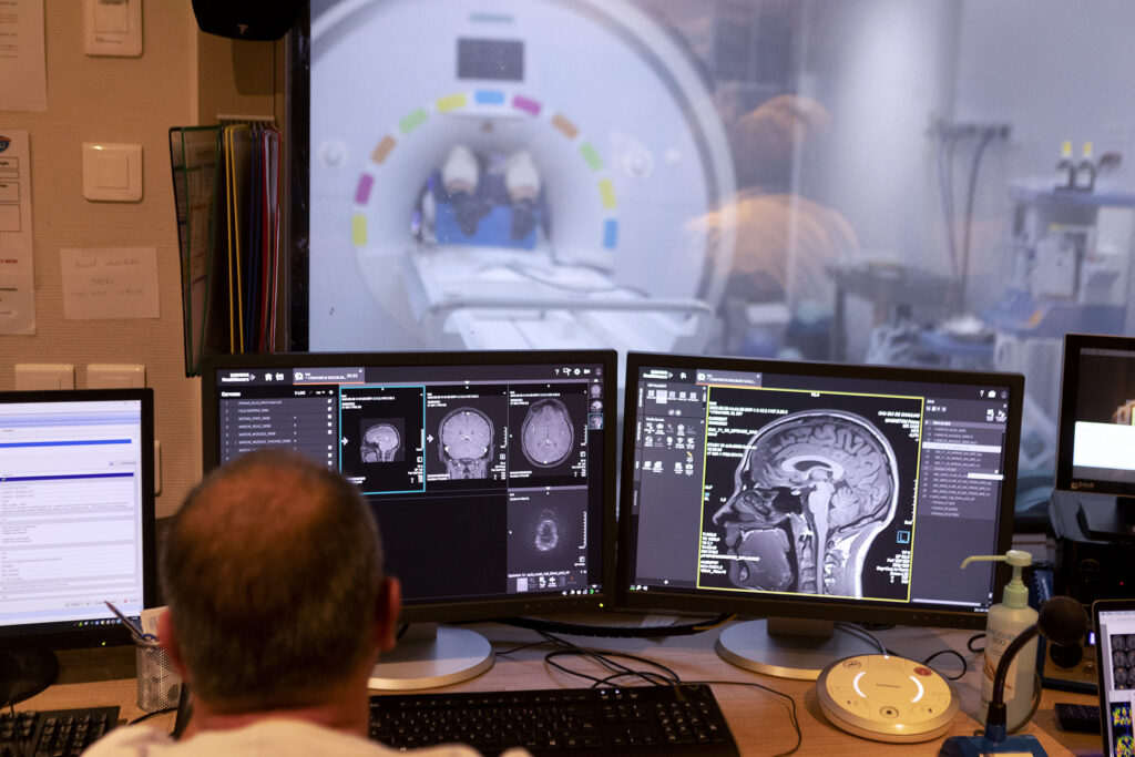 Studiu: Anumite combinații de medicamente ar putea încetini evoluția Alzheimerului