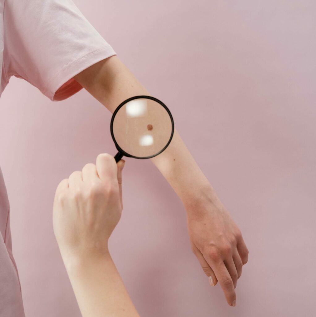 Studiu: Care sunt părțile corpului unde bărbații și femeile dezvoltă cancer de piele