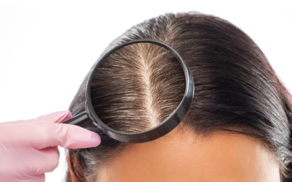 Ce definește un șampon antimătreață bun pentru păr și scalp? (P)
