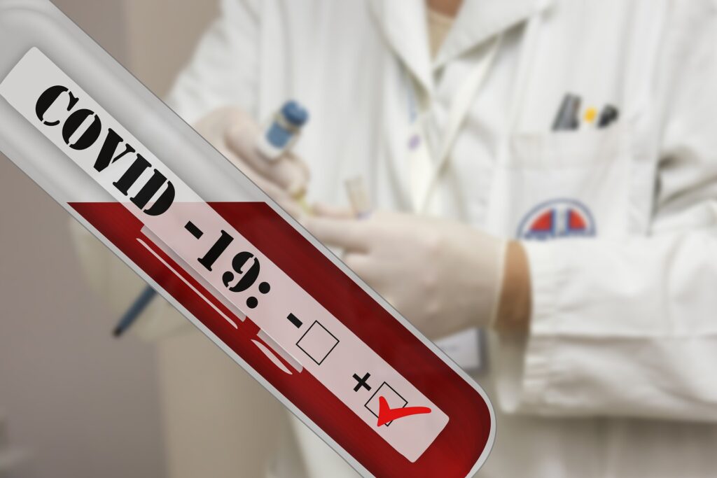 Misterul pierderii gustului după COVID-19, mai aproape de a fi elucidat. Ce se întâmplă în organism