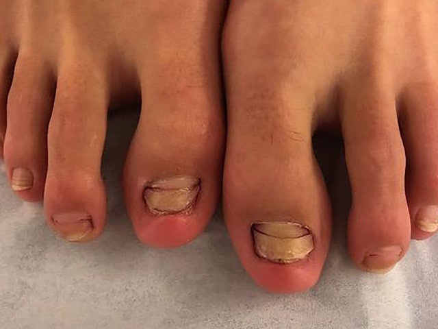 Foto: JAMA Dermatology